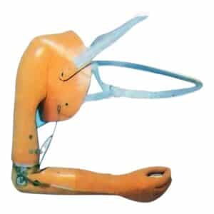 Proteză de dezarticulație scapulotoracică